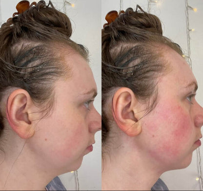 Vibemira ThermalSculpt Pro